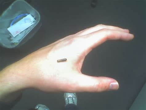 FDA Approves RFID Tags For Humans 